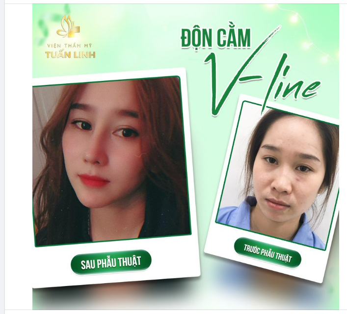 DẤU HIỆU CỦA SỰ TRƯỞNG THÀNH: ĐI ĐỘN CẰM ĐỂ THAY ĐỔI PHONG THỦY VÀ TRỞ NÊN XINH ĐẸP HƠN!!!