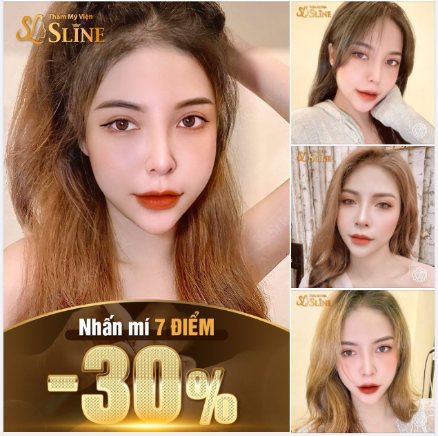 NHẤN MÍ 7 ĐIỂM.