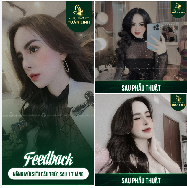 Dáng mũi cao bay thanh tú, tự nhiên pha chút cao tây làm nổi bật khuôn mặt xinh đẹp cá tính của cô nàng.