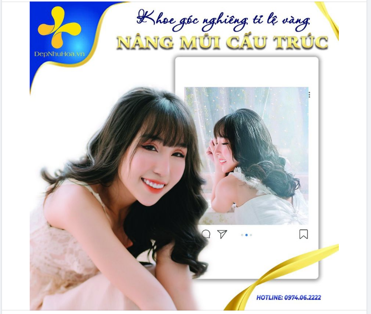 TẠI SAO NHIỀU KHÁCH HÀNG LỰA CHỌN NÂNG MŨI CẤU TRÚC???