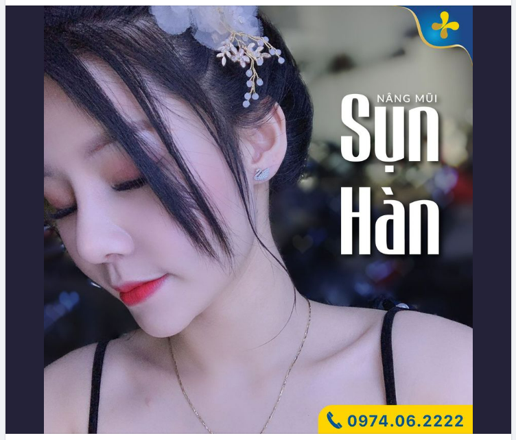 XINH LUNG SAU NÂNG MŨI 20 NGÀY TUỔI