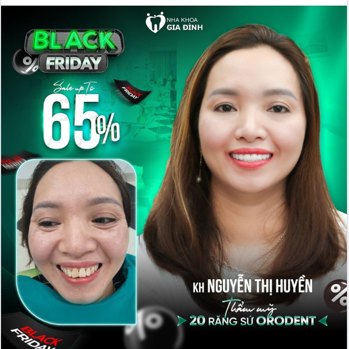 CƠ HỘI THAY ĐỔI NỤ CƯỜI -TIẾT KIỆM CHI PHÍ NGAY TRONG TUẦN VÀNG ƯU ĐÃI