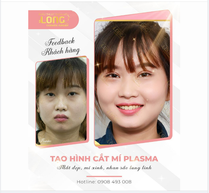 MÍ ĐẸP NHẸ NHÀNG - CÔNG NGHỆ CHUẨN HÀN