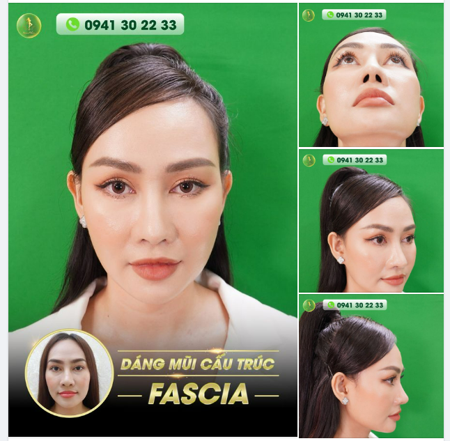 MC KIM DUYÊN KHOE TỶ LỆ VÀNG KHÔNG GÓC CH.ẾT