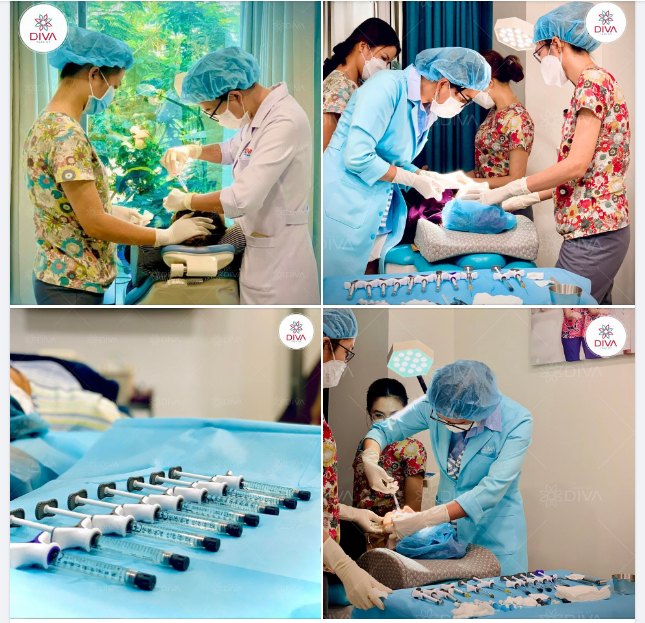 TIÊM FILLER MD CODES: PHƯƠNG PHÁP NGĂN CHẶN CHẢY XỆ HIỆU QUẢ NHẤT