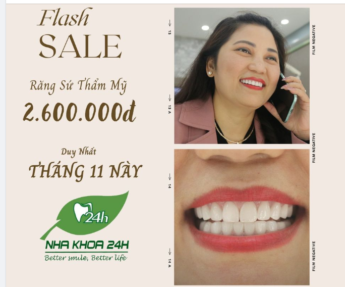 CHỈ TỪ 2,6 TRIỆU, RĂNG TRẮNG BẬT TÔNG - TỰ TIN KHOE NỤ CƯỜI