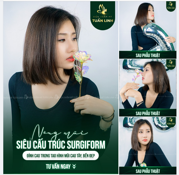 Từ phương pháp nâng mũi cho tới loại sụn sử dụng sẽ giúp bạn có được dáng mũi như mong muốn, cao tây sang chảnh thời thượng và đảm bảo an toàn, bền đẹp, hợp phong thủy.