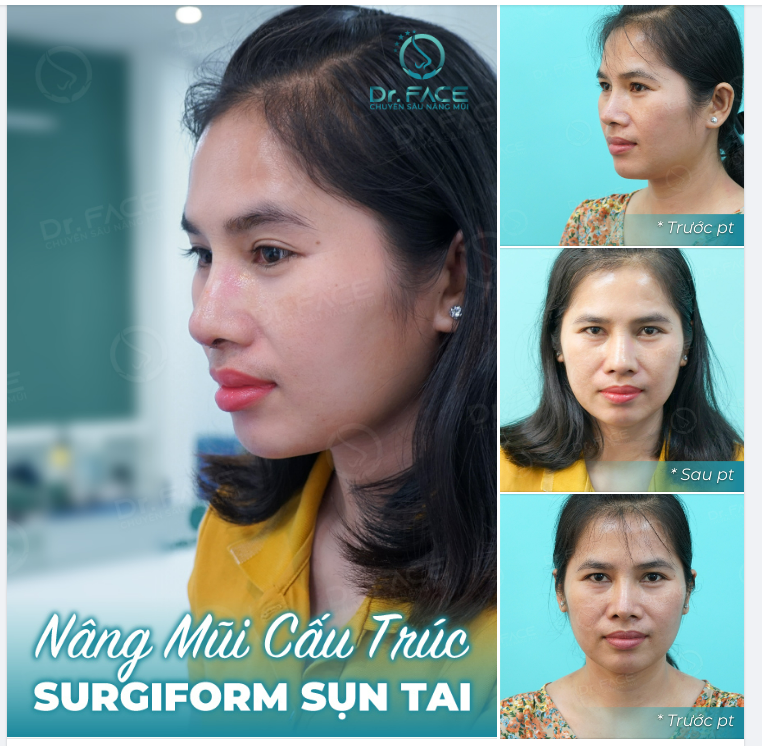 Đầu mũi TRÒN VS đầu mũi NHỌN - Cái nào ổn hơn?