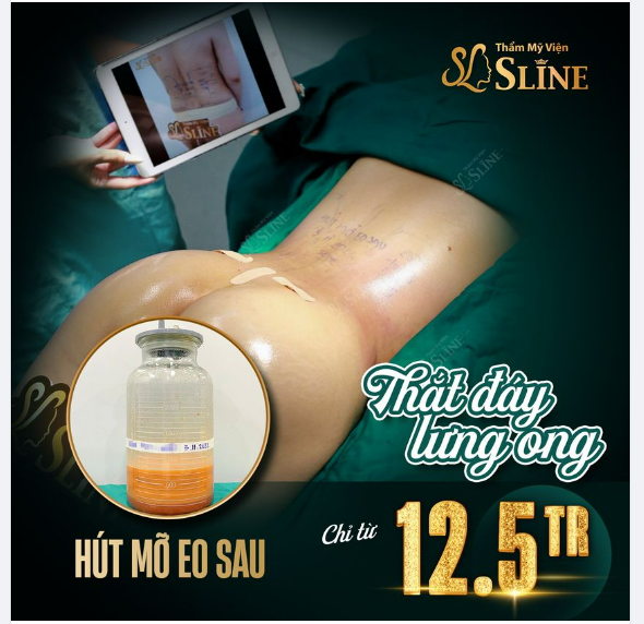 Thắt đáy lưng ong Với dịch vụ hút mỡ eo sau