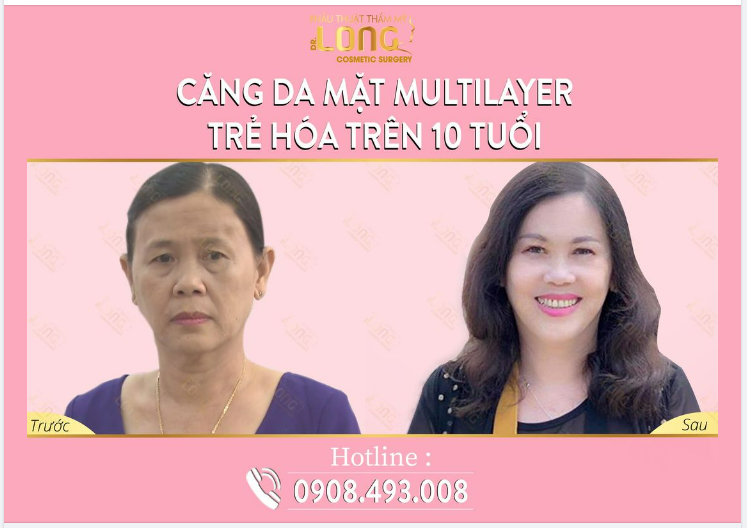 Một bí mật của làn da mang đến sức hút với tất cả chị em phụ nữ. Đây là giải pháp mang lại hiệu quả cao, BIẾN BẠN TỪ U50 THÀNH 30 40 là chuyện không hề khó,