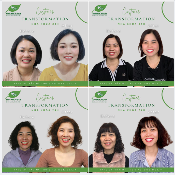 CHỈ TỪ 2,6 TRIỆU, RĂNG TRẮNG BẬT TÔNG - TỰ TIN KHOE NỤ CƯỜI