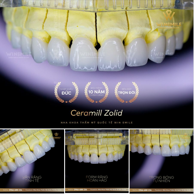SIÊU PHẨM SỨ CERAMILL - MẢNH GHÉP CHO NỤ CƯỜI HOÀN HẢO