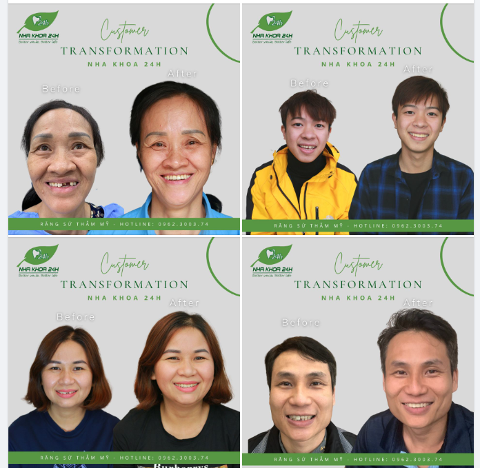 ĐẶT LỊCH LIỀN TAY - NHẬN NGAY ƯU ĐÃI 40% RĂNG SỨ THẨM MỸ - CHỈ TỪ 2,6TR/RĂNG