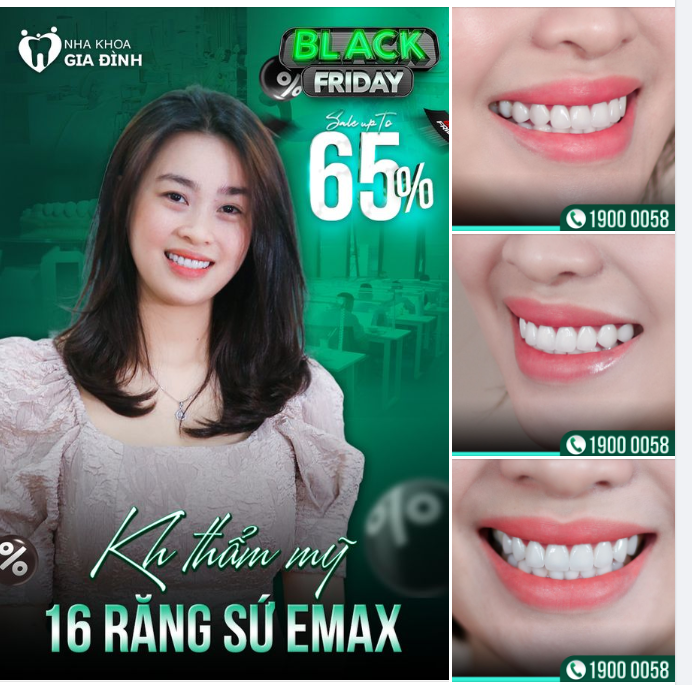 LÀM RĂNG ĐẸP - CƯỜI XINH NHƯ MẪU