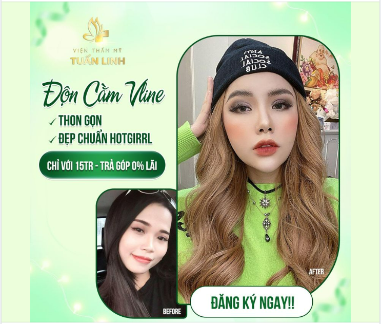 15 TR SỞ HỮU NGAY CHIẾC CẰM VLINE THON GỌN CHUẨN HOTGIRL 
