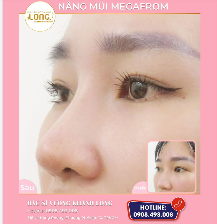 TƯỞNG KHÔNG XINH AI NGỜ “XINH KHÔNG TƯỞNG”