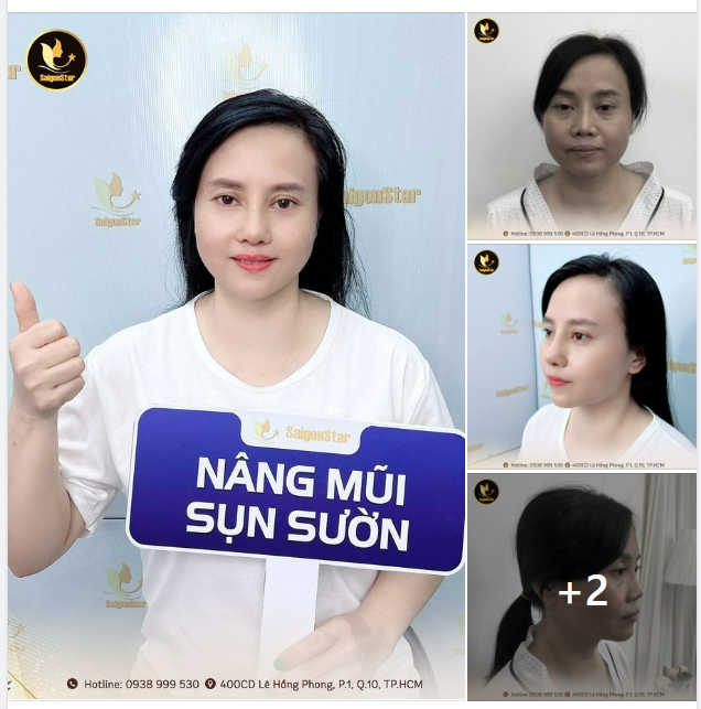 CỰC CĂNG! DÁNG MŨI 10 NGÀY ĐẸP TOÀN DIỆN CỦA VIỆT KIỀU ĐÀI LOAN