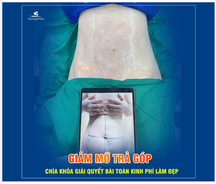 CHI PHÍ - RÀO CẢN CHÍNH NGĂN BẠN GIẢM MỠ