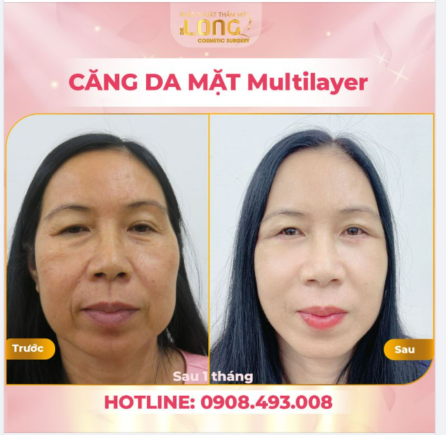 LÃO HÓA DA - ĐỪNG KÊU CA VÔ ÍCH - HÀNH ĐỘNG NGAY ĐỂ DA TRẺ RA
