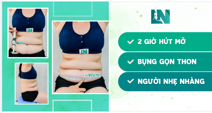 NGƯỜI NHẸ NHÀNG – DÁNG GỌN THON!