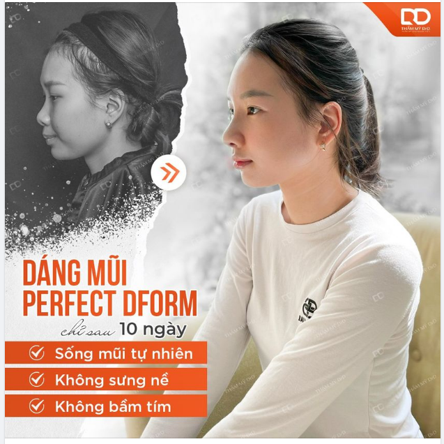 MŨI SAU 10 NGÀY SẼ NHƯ THẾ NÀO?