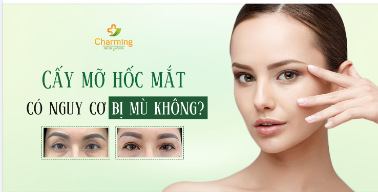 CẤY MỠ HỐC MẮT CÓ KHIẾN BẠN BỊ MÙ KHÔNG?