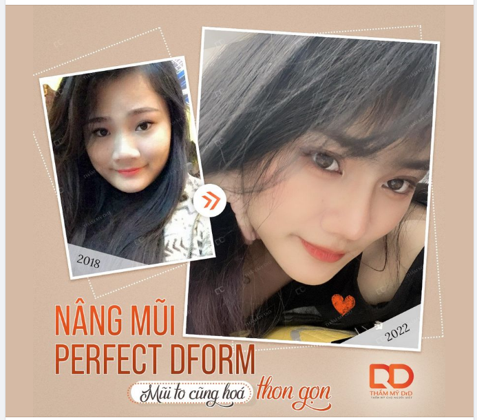 MỖI DÁNG MŨI - MỘT TÌNH TRẠNG