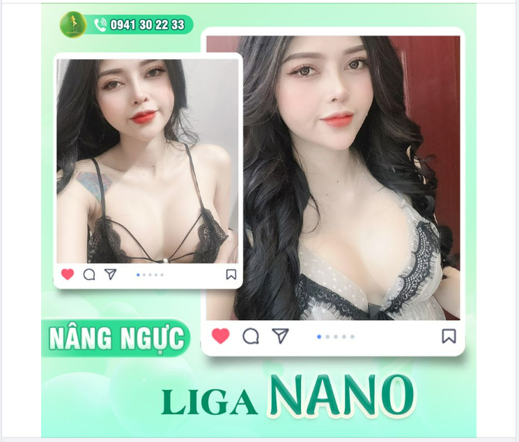 FEEDBACK ĐẸP KHÔNG TÌ VẾT VỚI DỊCH VỤ LIGA NANO