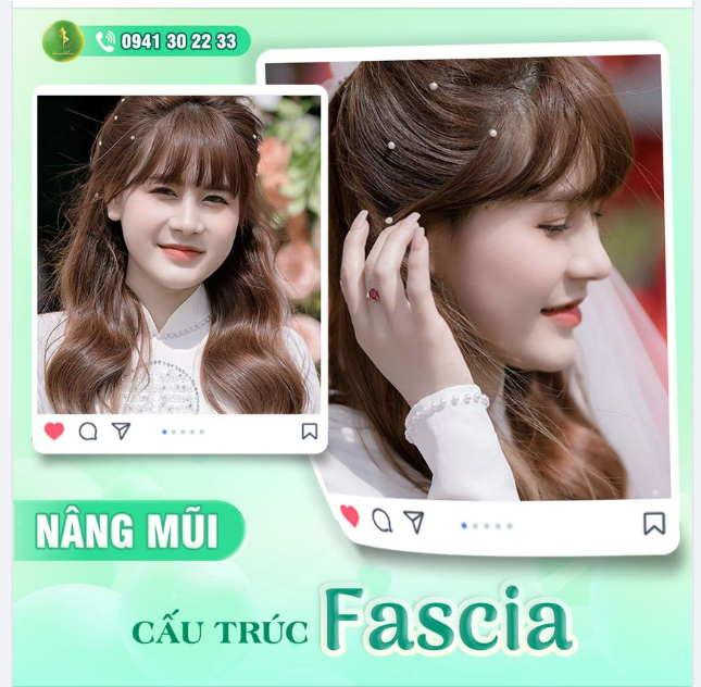 MŨI ĐẸP CHUẨN MỌI GÓC ĐỘ - ĐẸP THĂNG HẠNG