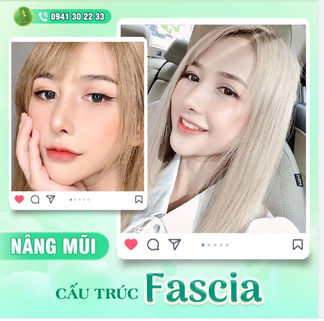 FEEDBACK DÁNG MŨI SAU 2 NĂM CỦA DIỄN VIÊN BĂNG BABY