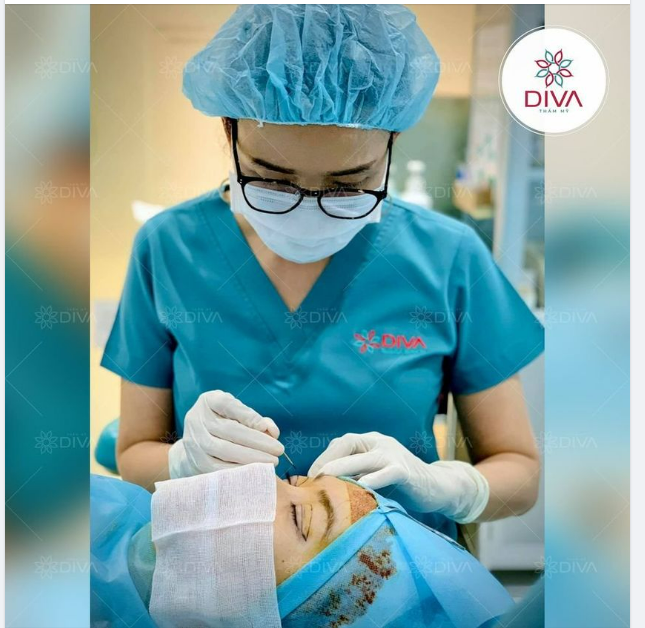 LÀM SAO ĐỂ SAU CẮT MÍ MẮT NẾP MÍ ĐẸP TỰ NHIÊN, CÂN ĐỐI?