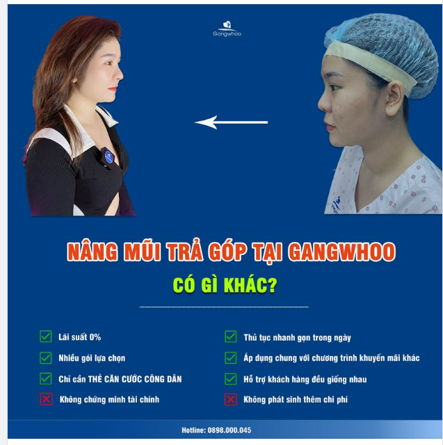 NÂNG MŨI TRẢ GÓP TẠI GANGWHOO CÓ GÌ KHÁC?