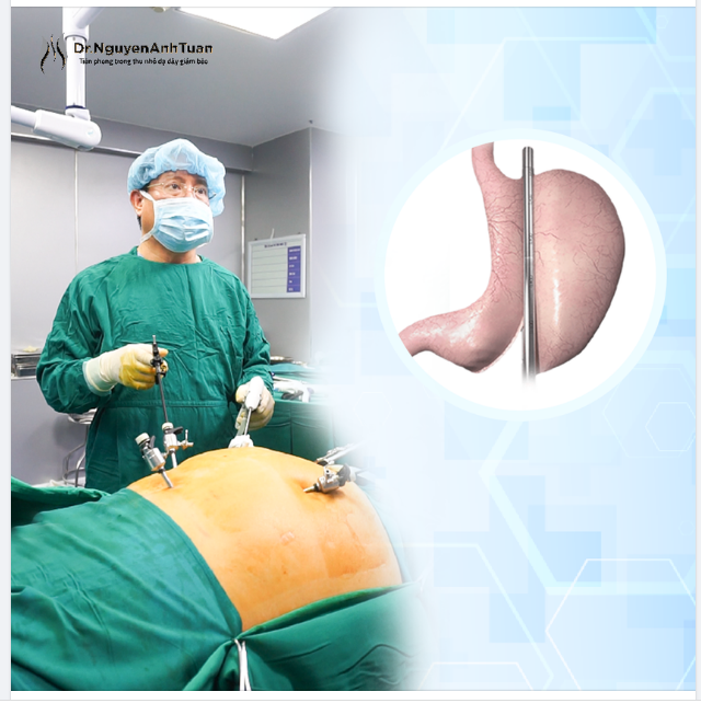 Vì sao phẫu thuật nội soi thu nhỏ dạ dày giảm béo đang được sử dụng phổ biến trên thế giới?