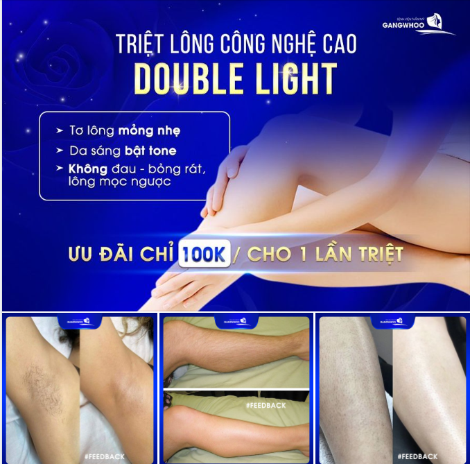 TRIỆT LÔNG CÔNG NGHỆ CAO DOUBLE LIGHT DA SÁNG BẬT TONE TƠ LÔNG MỎNG NHẸ