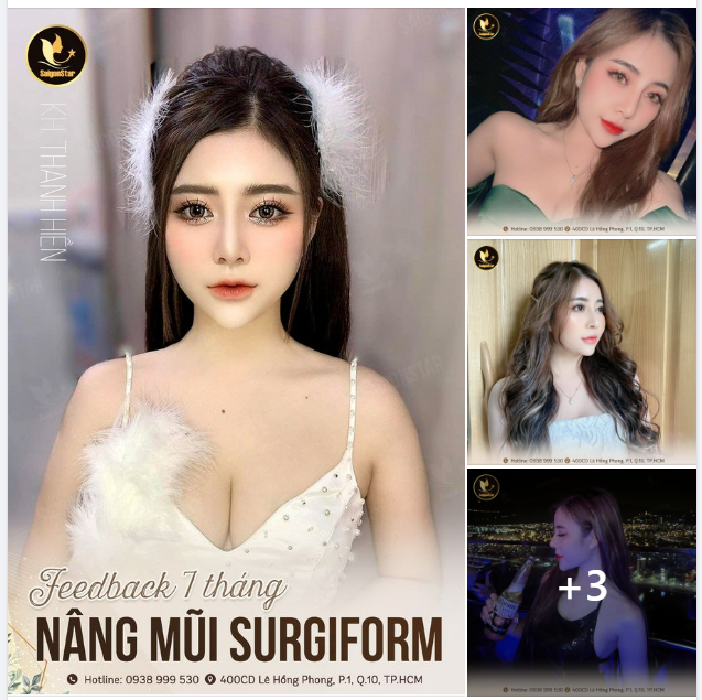 Chào tuần mới cả nhà thân yêu Khoe với cả nhà 1 chiếc feedback “so hot” của nàng thơ nhà Saigon Star – Thanh Hiền sau 7 tháng nâng mũi Surgiform: