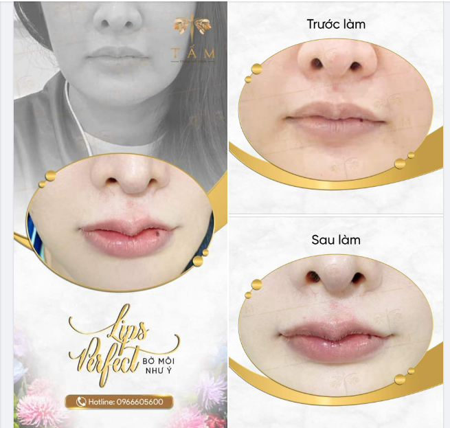 MÔI XINH DUYÊN DÁNG - TỰ TIN MỌI KHOẢNH KHẮC