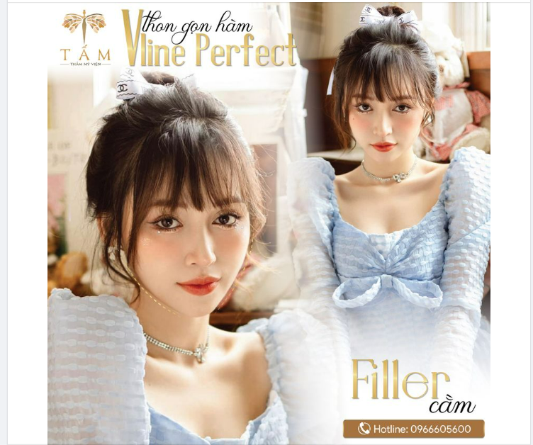 Vẻ đẹp tự nhiên với Vline Perfect và Filler cằm tại Thẩm mỹ viện Tấm