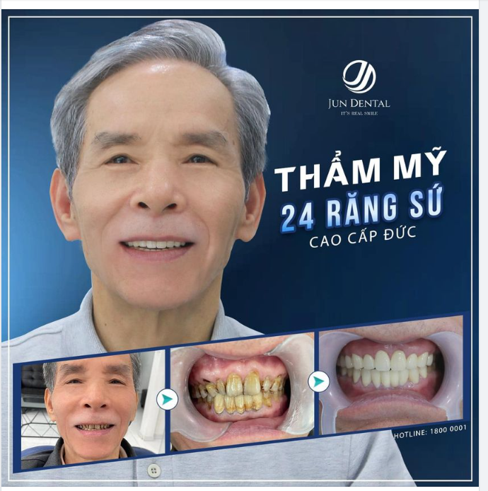 RĂNG ĐỀU TĂM TẮP NẮM BẮT YÊU THƯƠNG