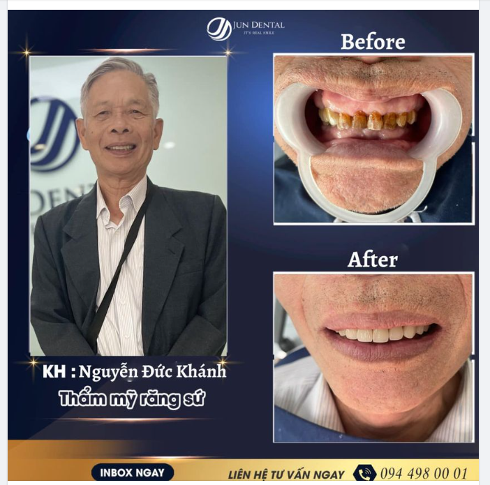 LAN TỎA NỤ CƯỜI - ĐÓN HẠNH PHÚC MỚI