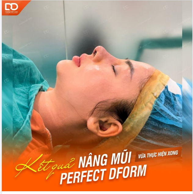 MUỐN DÁNG MŨI TỰ NHIÊN NHƯNG VẪN ĐỦ ĐỘ BAY THAM KHẢO NGAY DÁNG MŨI PERFECT DFORM