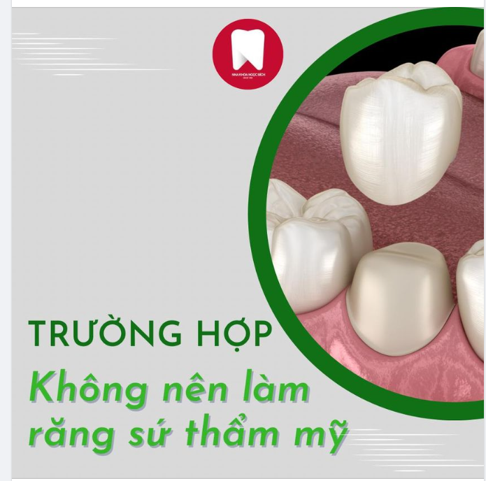 NHỮNG TRƯỜNG HỢP KHÔNG NÊN BỌC RĂNG SỨ THẨM MỸ