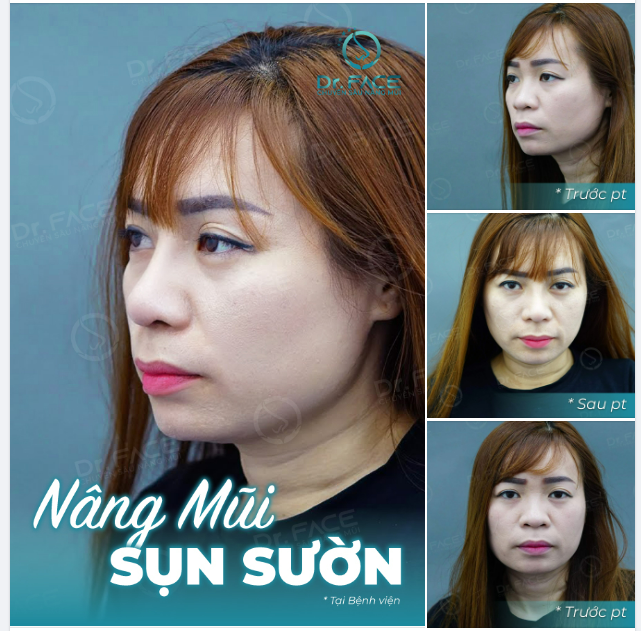 Em còn ngại gì mà chưa thay đổi Dòng người ngoài kia đã vượt xa em rồi…!