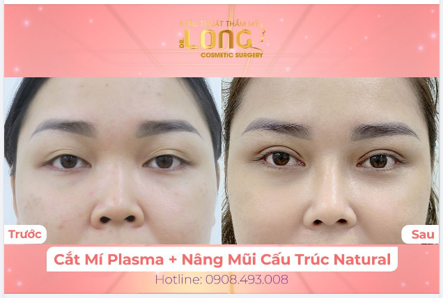 BLACK FRIDAY SẮM NGAY COMBO NHAN SẮC