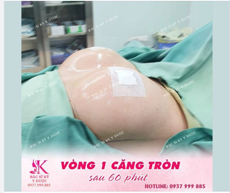 Vòng 1 VẠN NGƯỜI MÊ chỉ sau 60 phút