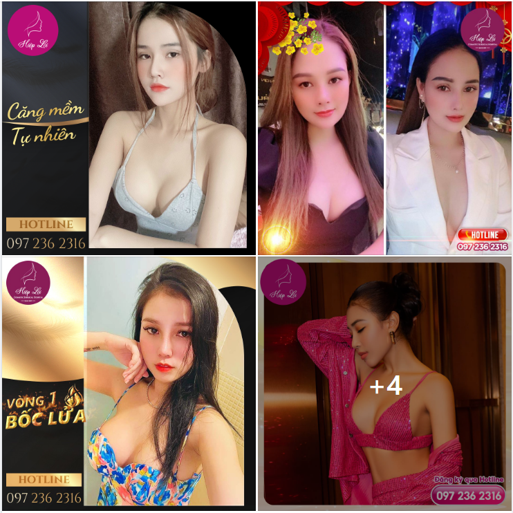 Cải thiện ngoại hình với phương pháp nâng V1 mới nhất tại Hiệp Lợi