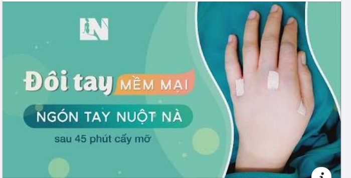 Bí quyết sở hữu đôi tay thon đẹp tự nhiên sau 45 phút  cấy mỡ trẻ hoá bàn tay.