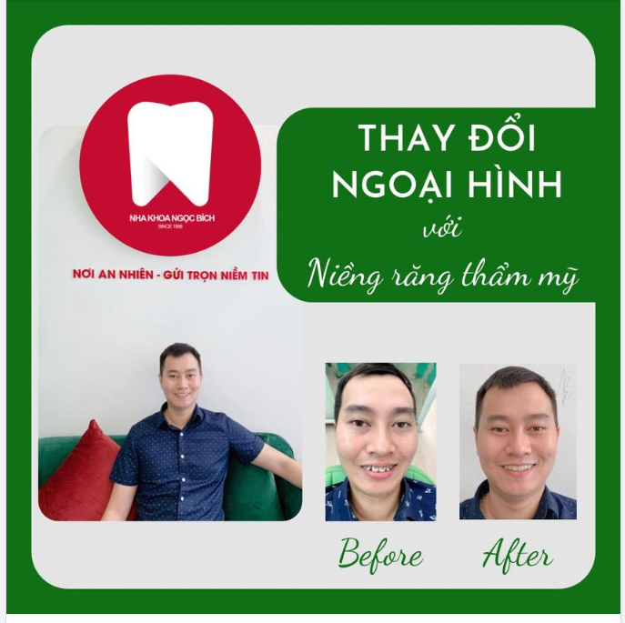 NỤ CƯỜI THĂNG HẠNG CHO CUỘC SỐNG THĂNG HOA