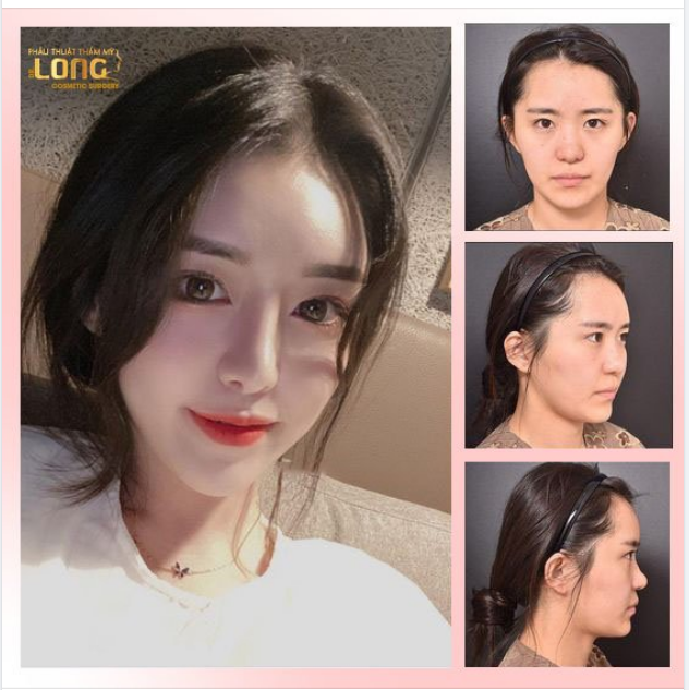 NÀNG NÀO LẬN ĐẬN TÌNH DUYÊN NÂNG MŨI THAY ĐỔI: LỘC TÀI TÌNH YÊU