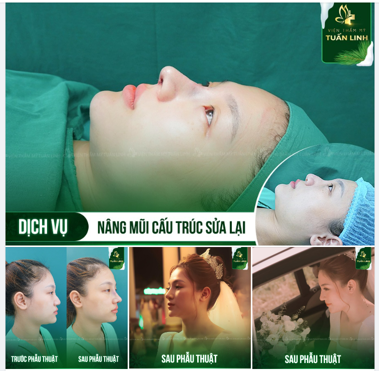 HÃY TRỞ THÀNH CÔ DÂU XINH ĐẸP NHẤT BẠN NHÉ!!