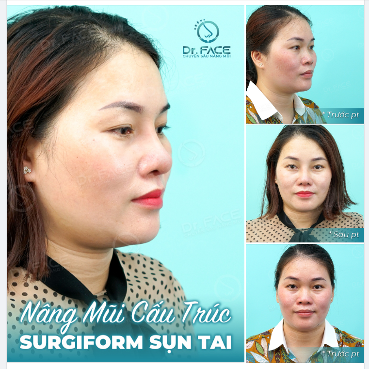Buổi sáng có nắng. Buổi chiều có em...!